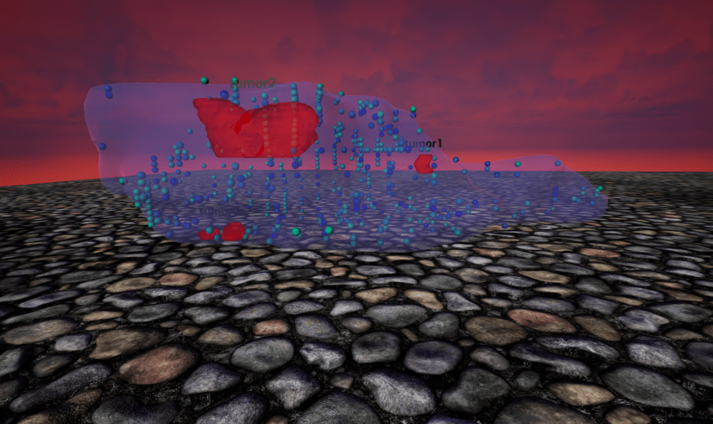 An image of a virtual reality model of a prostate.