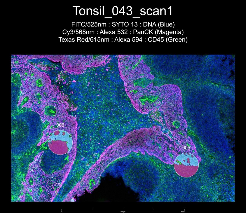 Picture output from GeoMx ROI selection from tonsil tissue guided by IF staining; cell nuclei (blue), cytokeratins (magenta) and immune cells (green).